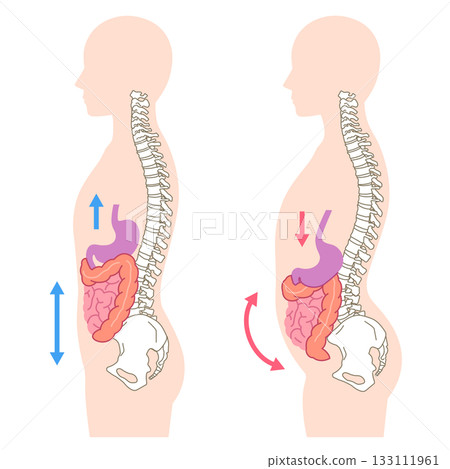 Visceroptosis: A condition in which the internal organs are lowered Visceroptosis: A condition in which the internal organs are lowered 133111961
