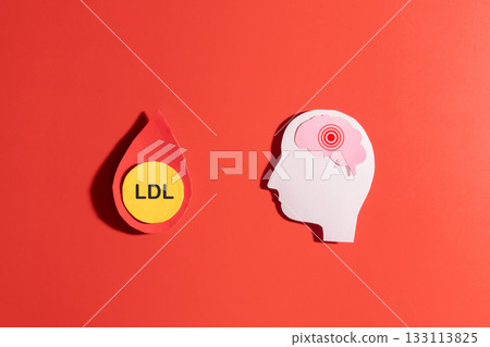 High LDL cholesterol increases the risk of stroke by boosting the risk of vascular disease. LDL cholesterol particles inside a blood droplet and human brain made from paper on red background. 133113825