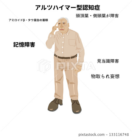 一幅老年人全身醫學插圖,展現了阿茲海默症的一些特徵:記憶力減退、定向障礙和β-澱粉樣蛋白沉積。 一幅老年人全身醫學插圖,展現了阿茲海默症的一些特徵:記憶力減退、定向障礙和β-澱粉樣蛋白沉積。 133116748