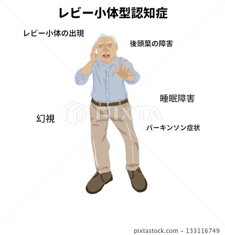 一張老年人全身醫學插圖，展示了路易氏體失智症的特徵：幻覺、巴金森氏症症狀和枕葉損傷。 133116749