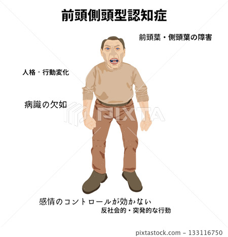 老年人全身醫學插圖，展現額顳葉失智症的特徵：人格改變、反社會行為和情緒控制障礙 133116750