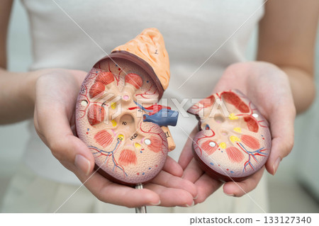 Chronic kidney disease, Asian woman with model for treatment urinary system, urology, Estimated glomerular filtration rate eGFR. 133127340