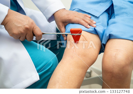 Asian doctor knock on knee reflex nerve for check and treatment senior patient in hospital. Asian doctor knock on knee reflex nerve for check and treatment senior patient in hospital. 133127748
