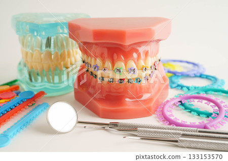 Orthodontic ligatures rings and ties, elastic rubber bands on orthodontic braces, model for dentist studying about dentistry. Orthodontic ligatures rings and ties, elastic rubber bands on orthodontic braces, model for dentist studying about dentistry. 133153570