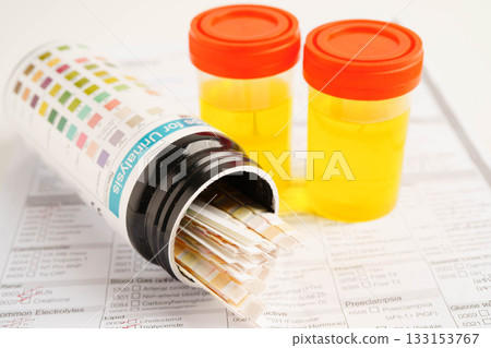 Urinalysis, urine cup with reagent strip pH paper test and comparison chart in laboratory. 133153767