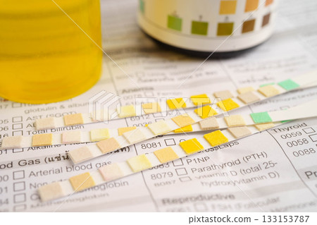 Urinalysis, urine cup with reagent strip pH paper test and comparison chart in laboratory. Urinalysis, urine cup with reagent strip pH paper test and comparison chart in laboratory. 133153787