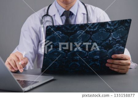doctor analyzing brain scan or MRI film working on a laptop, representing radiology, diagnosis, and modern medical technology in neurological assessment. doctor analyzing brain scan or MRI film working on a laptop, representing radiology, diagnosis, and modern medical technology in neurological assessment. 133158877