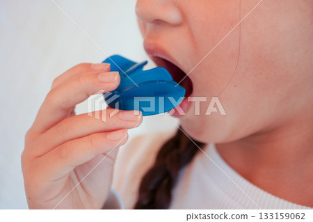 Orthodontics for children using pre-orthodontics 133159062