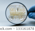 Dental Implant Model Under Magnifying Glass 133161878