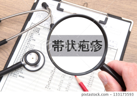 Shingles medical image Shingles medical image 133173593