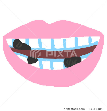 A mouth with dirty teeth A mouth with dirty teeth 133174849