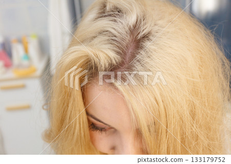 Woman showing blonde hair roots Woman showing blonde hair roots 133179752
