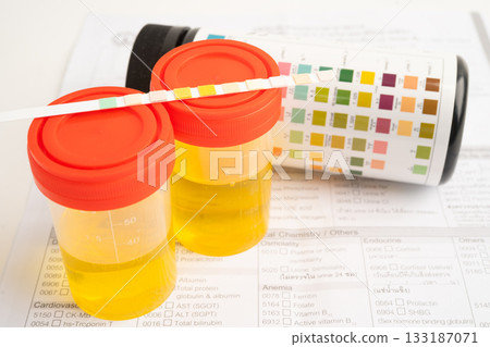 Urinalysis, urine cup with reagent strip pH paper test and comparison chart in laboratory. 133187071