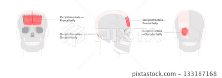 Occipitofrontalis - Human scalp muscle that raises the eyebrows and wrinkles the forehead, depicted in detailed anatomy 133187168