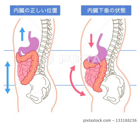 內臟下垂：內臟器官下垂的一種狀況 133188236