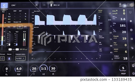Medical ventilator screen showing patient's respiratory parameters. Media 133189435