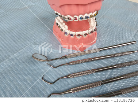 Dental tools arranged beside a model of teeth with braces at a dental clinic a routine check-up 133195726