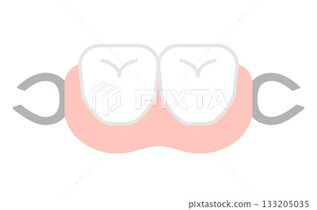 Cute and simple nursing care illustration material for orthodontics and partial dentures Cute and simple nursing care illustration material for orthodontics and partial dentures 133205035