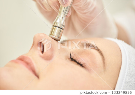 Female receiving facial microdermabrasion treatment caucasian adult close-up 133249856