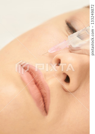 Female receiving cosmetic injection in cheek close-up view Female receiving cosmetic injection in cheek close-up view 133249872