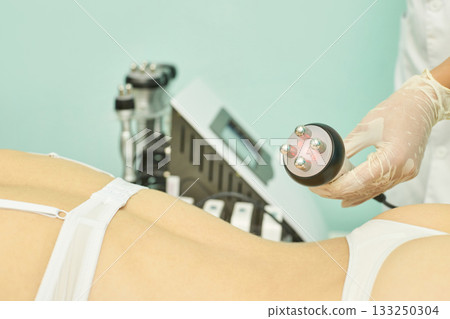 Female adult skin treatment with advanced radiofrequency machine in clinic 133250304