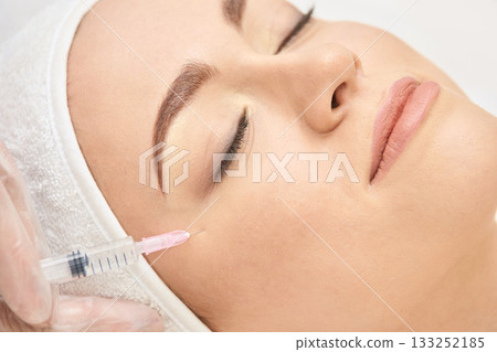 Young caucasian female receiving facial injection for cosmetic treatment 133252185