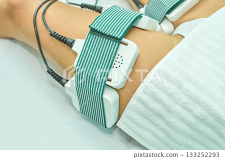 Close-up of female receiving laser therapy on thigh with electrode straps Close-up of female receiving laser therapy on thigh with electrode straps 133252293