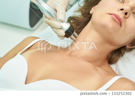 Female receiving radiofrequency facial treatment in spa clinic for skin Female receiving radiofrequency facial treatment in spa clinic for skin 133252302