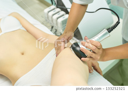 Ultrasound cavitation treatment on young caucasian female thighs in modern spa Ultrasound cavitation treatment on young caucasian female thighs in modern spa 133252321