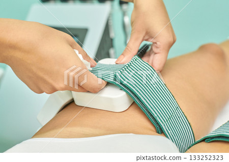 Female adult undergoing abdominal fat reduction treatment with cooling device Female adult undergoing abdominal fat reduction treatment with cooling device 133252323