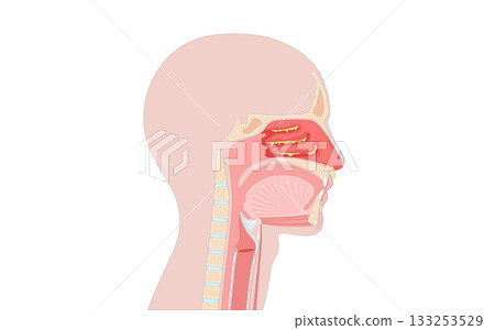 Allergic rhinitis poster 133253529