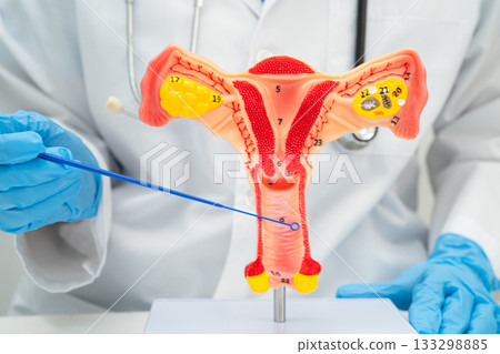 Doctor holding human uterus model for vaginal and cervix pap smear check up in the obstetrics and gynecology. Doctor holding human uterus model for vaginal and cervix pap smear check up in the obstetrics and gynecology. 133298885