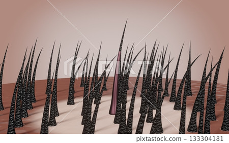 Hair follicles - regeneration concept - 3D illustration 133304181
