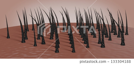 Dried and damaged hair follicles - 3D illustration 133304188
