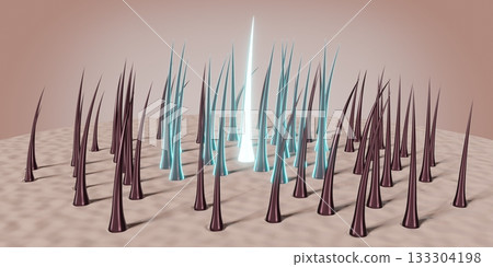 Hair follicles - regeneration concept - 3D illustration Hair follicles - regeneration concept - 3D illustration 133304198