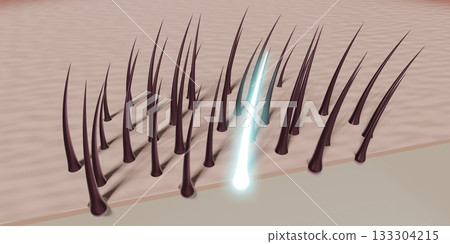 Hair follicles - regeneration concept - 3D illustration 133304215