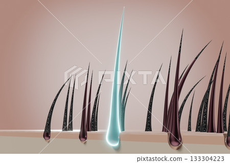Hair follicles - regeneration concept - 3D illustration 133304223