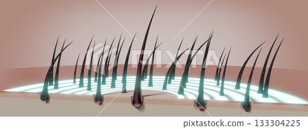 Hair follicles - regeneration concept - 3D illustration 133304225
