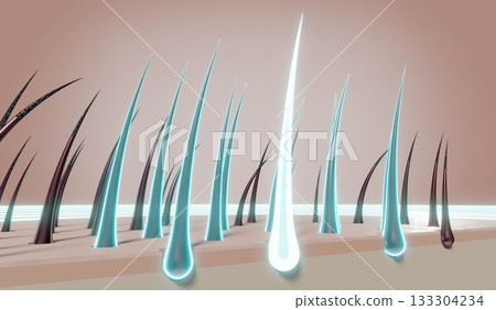 Hair follicles - regeneration concept - 3D illustration Hair follicles - regeneration concept - 3D illustration 133304234