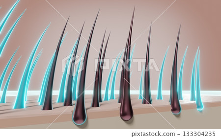 Hair follicles - regeneration concept - 3D illustration Hair follicles - regeneration concept - 3D illustration 133304235