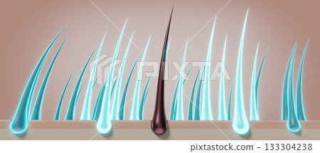 Hair follicles - regeneration concept - 3D illustration 133304238