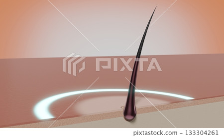 Single hair follicle and round glow - regeneration concept - 3D illustration Single hair follicle and round glow - regeneration concept - 3D illustration 133304261