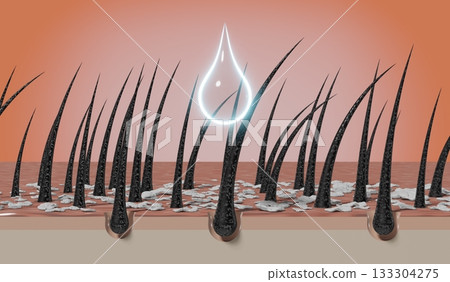 Hair follicles and shampoo treatment against dandruff - 3D illustration 133304275