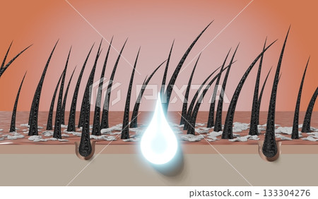 Hair follicles and shampoo treatment against dandruff - 3D illustration Hair follicles and shampoo treatment against dandruff - 3D illustration 133304276