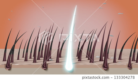 Hair follicles and shampoo treatment against dandruff - 3D illustration 133304278