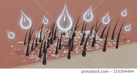 Hair follicles and shampoo treatment against dandruff - 3D illustration Hair follicles and shampoo treatment against dandruff - 3D illustration 133304494