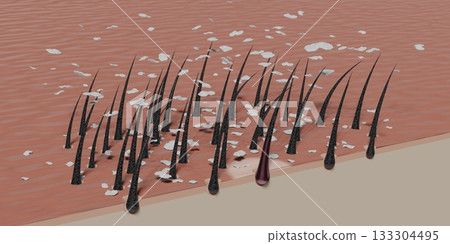 Hair follicles and dandruff under microscope - 3D illustration 133304495