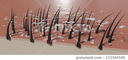 Hair follicles and dandruff under microscope - 3D illustration 133304500