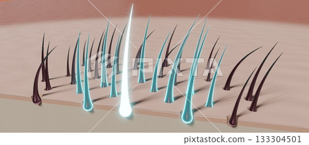 Hair follicles - regeneration concept - 3D illustration Hair follicles - regeneration concept - 3D illustration 133304501
