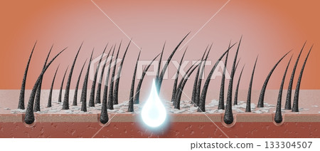 Hair follicles and shampoo treatment against dandruff - 3D illustration 133304507